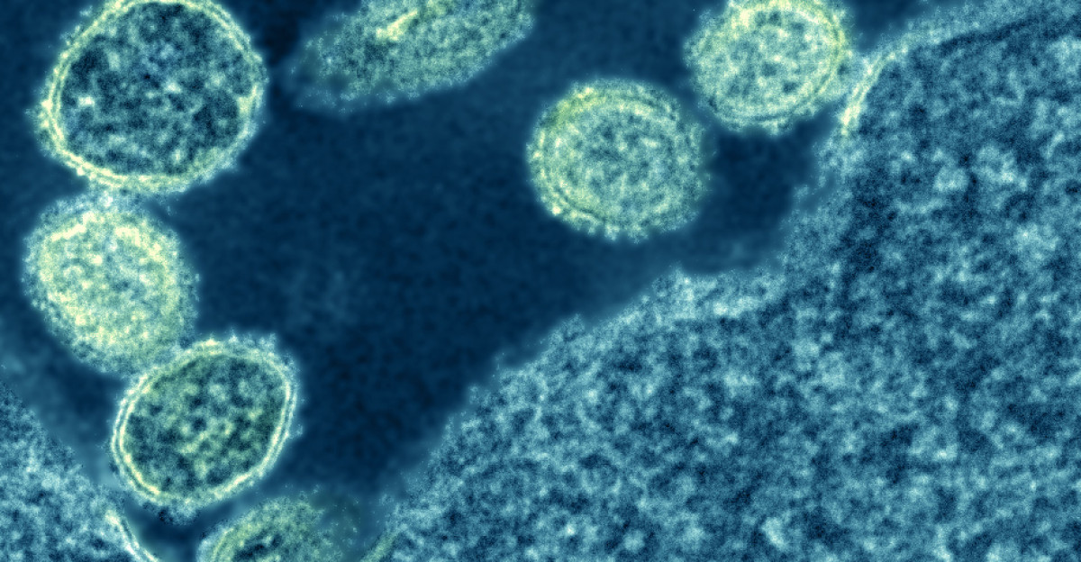 Electron micrograph of 1918 H1N1 influenza virus particles near a cell Credit NIAID